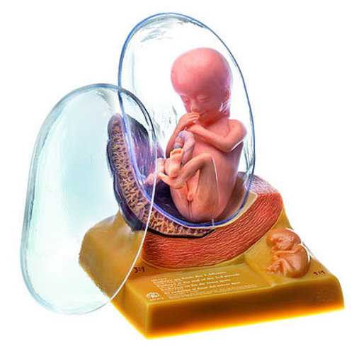 Human Embryo in the Third Month (MS 11/3)