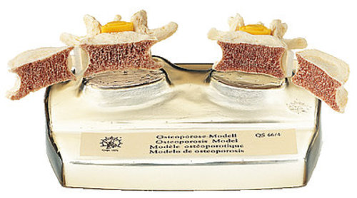 Osteoporosis Model (QS 66/4)