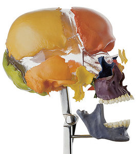 Artificial Bauchene Skull of an Adult (QS 9/5)