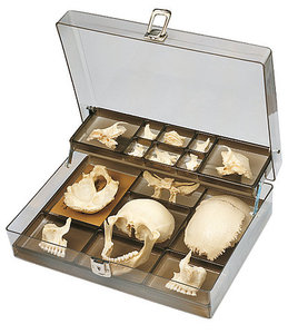 Artificial Bauchene Skull of an Adult (QS 9/1)