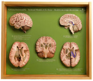 5 Section Models of the Brain (BS 45)