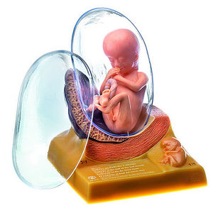 Human Embryo in the Third Month (MS 11/3)