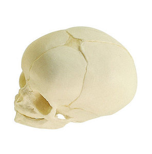 Artificial Skull of a Fetus (QS 3/3)