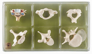 Case with Collection (Vertebrae and Spinal Cord) (QS 54)