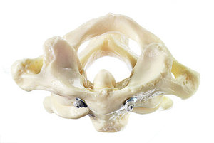 First and Second Cervical Vertebrae (QS 17/1)