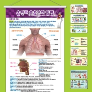 흡연과 호흡기의 질병/COPD,폐암,천식(족자형) kim3-459