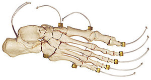 Skeleton of the Foot on Nylon (QS 24-N)