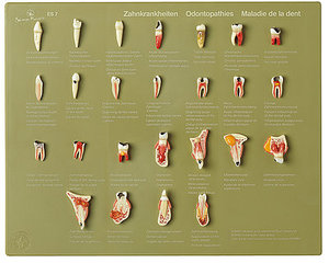 Case of Teeth &quot;Odontopathies&quot; (ES 7)