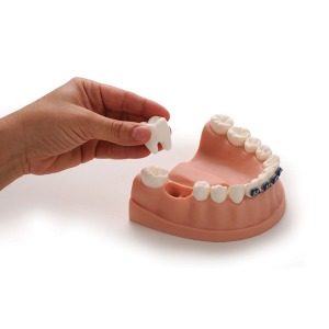 치아관리모형[79229]