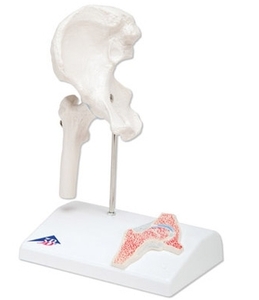 Mini Hip Joint with cross-section (A84/1)