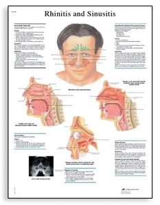 Rhinitis and Sinusitis Chart(VR1251)