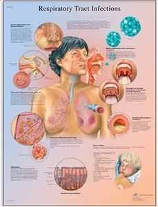 Respiratory Tract Infections Chart(VR1253)
