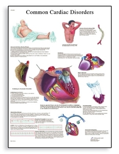 Common Cardiac Disorders Chart(VR1343)