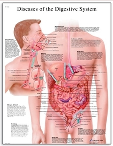 Diseases of the Digestive System Chart(VR1431)