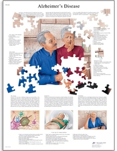 Alzheimer&#039;s Disease Chart(VR1628)