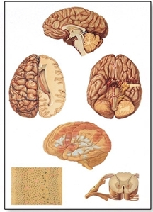 Human Central Nervous System Chart(V2034)