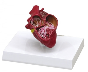 기생충에 감염된 개 심장 [Canine Heart with Heartworm (VET1150)]