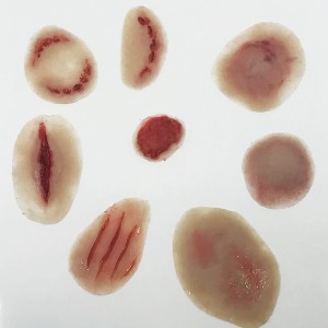 유아 혈종, 선천성 모반[MP019] 접착식 외상모형